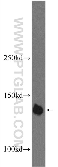 PHF20 Rabbit anti-Human, Mouse, Polyclonal, Proteintech:Antibodies:Primary