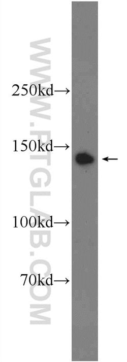PHF20 Rabbit anti-Human, Mouse, Polyclonal, Proteintech:Antibodies:Primary