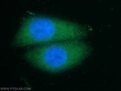 NFATC2 Rabbit anti-Human, Mouse, Polyclonal, Proteintech:Antibodies:Primary