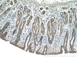 NFATC2 Rabbit anti-Human, Mouse, Polyclonal, Proteintech:Antibodies:Primary