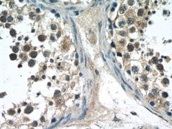 NFATC2 Rabbit anti-Human, Mouse, Polyclonal, Proteintech:Antibodies:Primary