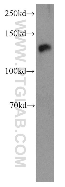 NFATC2 Rabbit anti-Human, Mouse, Polyclonal, Proteintech:Antibodies:Primary