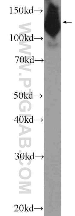 NFATC2 Rabbit anti-Human, Mouse, Polyclonal, Proteintech:Antibodies:Primary
