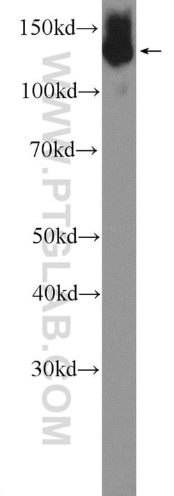 NFATC2 Rabbit anti-Human, Mouse, Polyclonal, Proteintech:Antibodies:Primary
