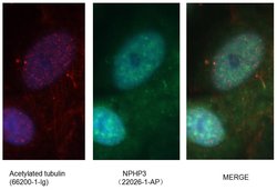 NPHP3 Rabbit anti-Human, Mouse, Polyclonal, Proteintech 150 &mu;L; Unconjugated:Antibodies,