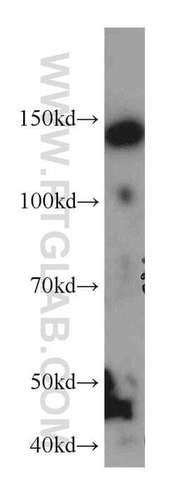 NPHP3 Rabbit anti-Human, Mouse, Polyclonal, Proteintech 150 &mu;L; Unconjugated:Antibodies,