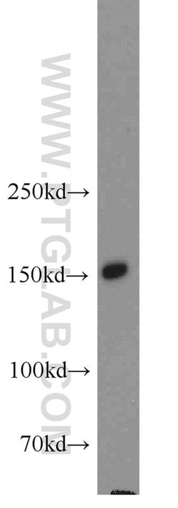 NPHP3 Rabbit anti-Human, Mouse, Polyclonal, Proteintech 150 &mu;L; Unconjugated:Antibodies,