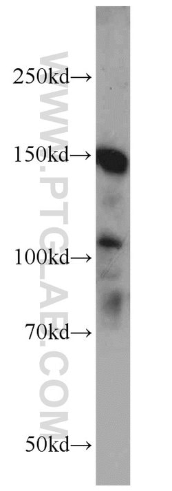 NPHP3 Rabbit anti-Human, Mouse, Polyclonal, Proteintech 150 &mu;L; Unconjugated:Antibodies,