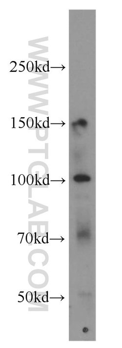 NPHP3 Rabbit anti-Human, Mouse, Polyclonal, Proteintech 150 &mu;L; Unconjugated:Antibodies,