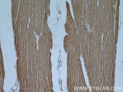 Hexokinase 2 Rabbit anti-Human, Mouse, Rat, Polyclonal, Proteintech:Antibodies:Primary