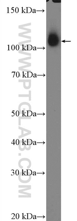 Hexokinase 2 Rabbit anti-Human, Mouse, Rat, Polyclonal, Proteintech:Antibodies:Primary