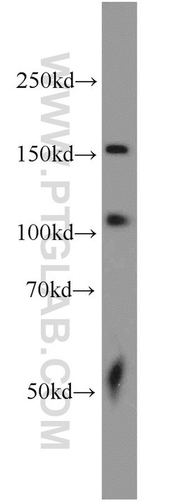 SARA Rabbit anti-Human, Mouse, Rat, Polyclonal, Proteintech 150 &mu;L;
