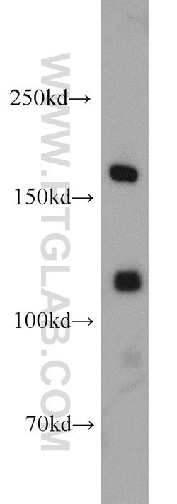 SARA Rabbit anti-Human, Mouse, Rat, Polyclonal, Proteintech 150 &mu;L;