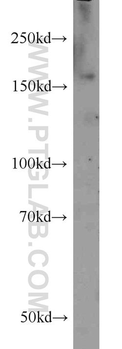 SARA Rabbit anti-Human, Mouse, Rat, Polyclonal, Proteintech 150 &mu;L;