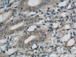 SARA Rabbit anti-Human, Mouse, Rat, Polyclonal, Proteintech 150 &mu;L;