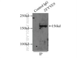 SARA Rabbit anti-Human, Mouse, Rat, Polyclonal, Proteintech 150 &mu;L;