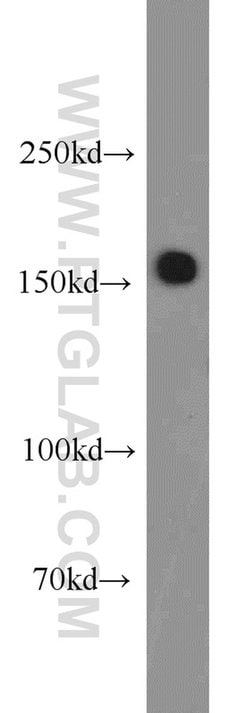 SARA Rabbit anti-Human, Mouse, Rat, Polyclonal, Proteintech 150 &mu;L;