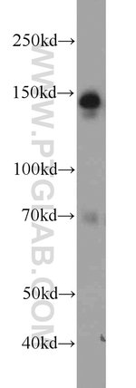 Thumbnail_AHI1 Rabbit anti-Human, Mouse, Polyclonal, Proteintech 150 &mu;L; Unconjugated:Antikörper