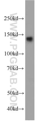 Thumbnail_AHI1 Rabbit anti-Human, Mouse, Polyclonal, Proteintech 150 &mu;L; Unconjugated:Antikörper
