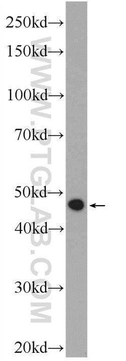 C5orf4 Rabbit anti-Human, Polyclonal, Proteintech 150 &mu;L; Unconjugated:Antibodies,