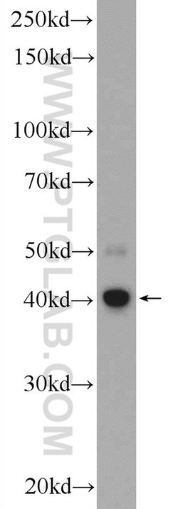 C5orf4 Rabbit anti-Human, Polyclonal, Proteintech 150 &mu;L; Unconjugated:Antibodies,