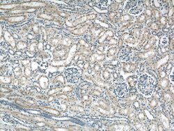 B3GALNT1 Rabbit anti-Human, Mouse, Rat, Polyclonal, Proteintech:Antibodies:Primary