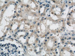 B3GALNT1 Rabbit anti-Human, Mouse, Rat, Polyclonal, Proteintech:Antibodies:Primary