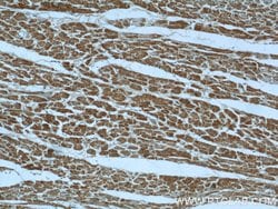 B3GALNT1 Rabbit anti-Human, Mouse, Rat, Polyclonal, Proteintech:Antibodies:Primary