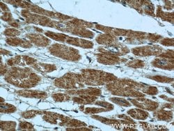 B3GALNT1 Rabbit anti-Human, Mouse, Rat, Polyclonal, Proteintech:Antibodies:Primary