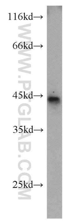 B3GALNT1 Rabbit anti-Human, Mouse, Rat, Polyclonal, Proteintech:Antibodies:Primary