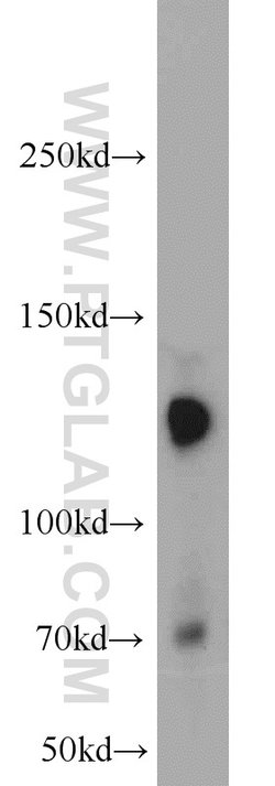 Cadherin-20 Rabbit anti-Human, Mouse, Rat, Polyclonal, Proteintech 150