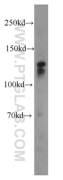 Cadherin-20 Rabbit anti-Human, Mouse, Rat, Polyclonal, Proteintech 150