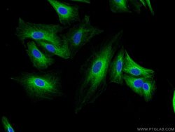MAGED1 Rabbit anti-Human, Mouse, Rat, Polyclonal, Proteintech:Antibodies:Primary