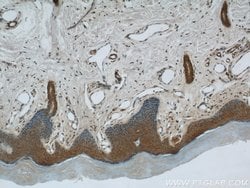 MAGED1 Rabbit anti-Human, Mouse, Rat, Polyclonal, Proteintech:Antibodies:Primary