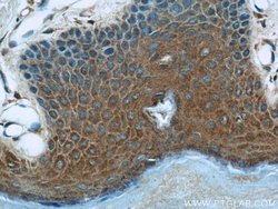 MAGED1 Rabbit anti-Human, Mouse, Rat, Polyclonal, Proteintech:Antibodies:Primary