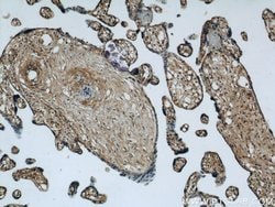 MAGED1 Rabbit anti-Human, Mouse, Rat, Polyclonal, Proteintech:Antibodies:Primary