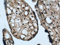MAGED1 Rabbit anti-Human, Mouse, Rat, Polyclonal, Proteintech:Antibodies:Primary