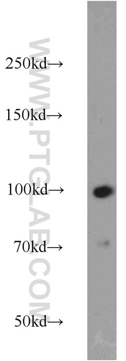 MAGED1 Rabbit anti-Human, Mouse, Rat, Polyclonal, Proteintech:Antibodies:Primary