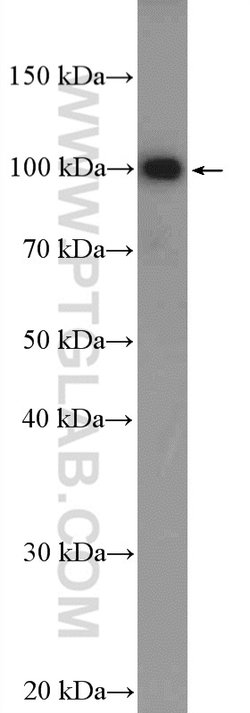 MAGED1 Rabbit anti-Human, Mouse, Rat, Polyclonal, Proteintech:Antibodies:Primary