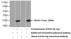 B9D2 Rabbit anti-Human, Polyclonal, Proteintech 150 &mu;L; Unconjugated:Anticuerpos