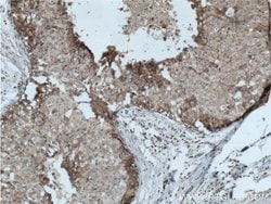 LTBP1 Rabbit anti-Human, Polyclonal, Proteintech 150 &mu;L | Buy Online | Proteintech Group Inc | Fisher Scientific