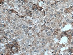 LTBP1 Rabbit anti-Human, Polyclonal, Proteintech 150 &mu;L | Buy Online | Proteintech Group Inc | Fisher Scientific
