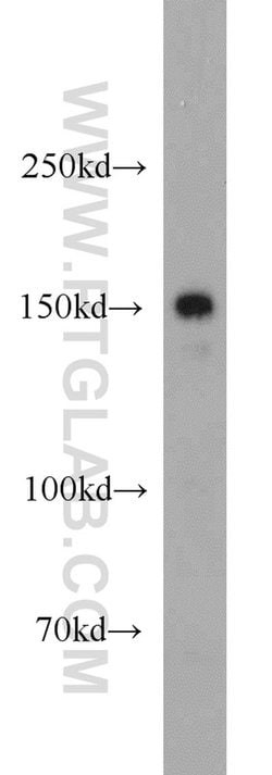 LTBP1 Rabbit anti-Human, Polyclonal, Proteintech 150 &mu;L | Buy Online | Proteintech Group Inc | Fisher Scientific
