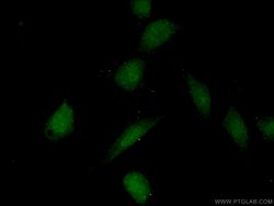 CDK8 Rabbit anti-Human, Mouse, Polyclonal, Proteintech 150 &mu;L; Unconjugated:Antibodies,