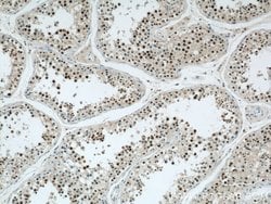 CDK8 Rabbit anti-Human, Mouse, Polyclonal, Proteintech 150 &mu;L; Unconjugated:Antibodies,