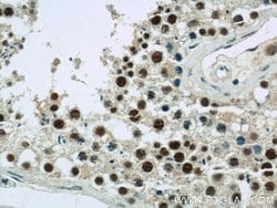 CDK8 Rabbit anti-Human, Mouse, Polyclonal, Proteintech 150 &mu;L; Unconjugated:Antibodies,