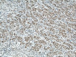 CDK8 Rabbit anti-Human, Mouse, Polyclonal, Proteintech 150 &mu;L; Unconjugated:Antibodies,