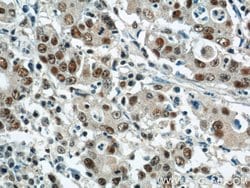CDK8 Rabbit anti-Human, Mouse, Polyclonal, Proteintech 150 &mu;L; Unconjugated:Antibodies,