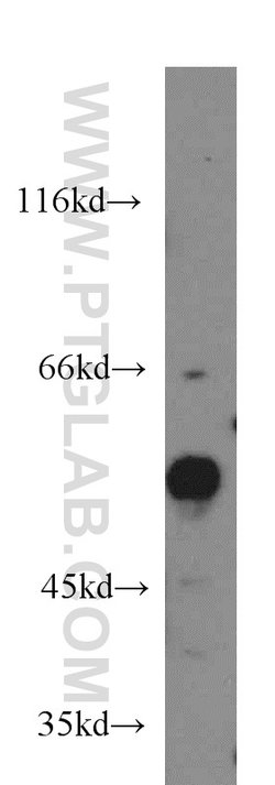CDK8 Rabbit anti-Human, Mouse, Polyclonal, Proteintech 150 &mu;L; Unconjugated:Antibodies,
