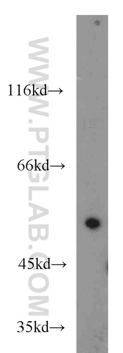 CDK8 Rabbit anti-Human, Mouse, Polyclonal, Proteintech 150 &mu;L; Unconjugated:Antibodies,